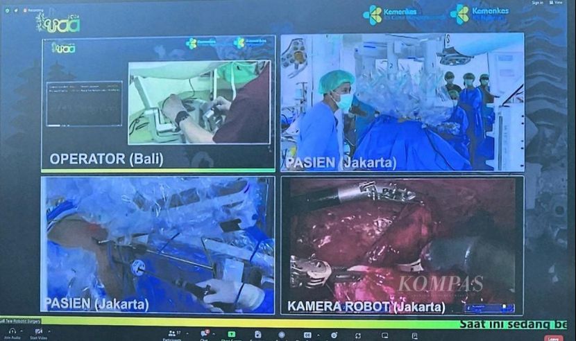印尼首次成功使用机器人进行远程手术