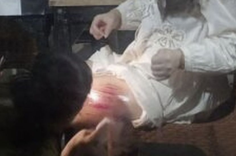 中国女游客在印尼不幸掉入人行道巨坑