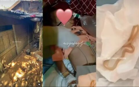 蛔虫太多竟自己从两岁幼童口鼻爬出