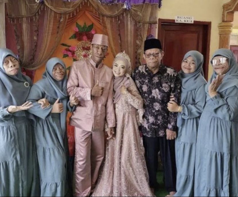 印尼新郎独特长相引发网络热议